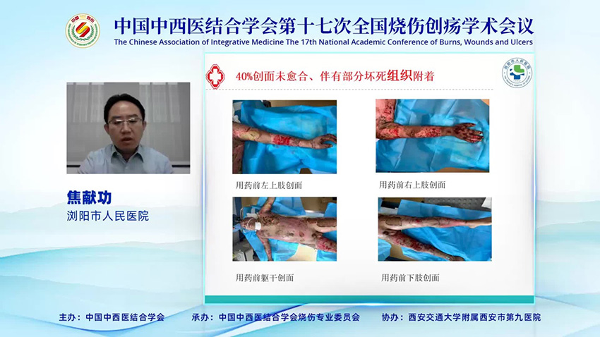 mg冰球突破豪华版(试玩)官方网站