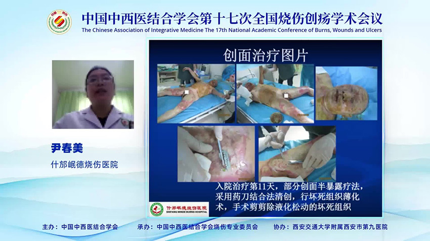 mg冰球突破豪华版(试玩)官方网站