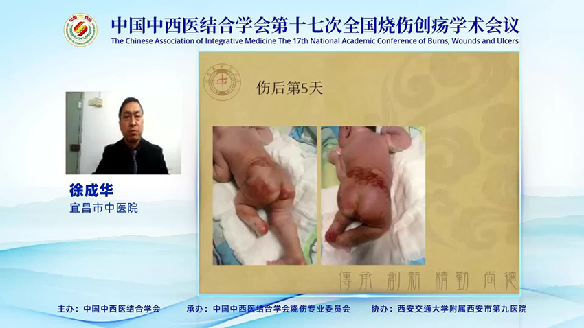 mg冰球突破豪华版(试玩)官方网站