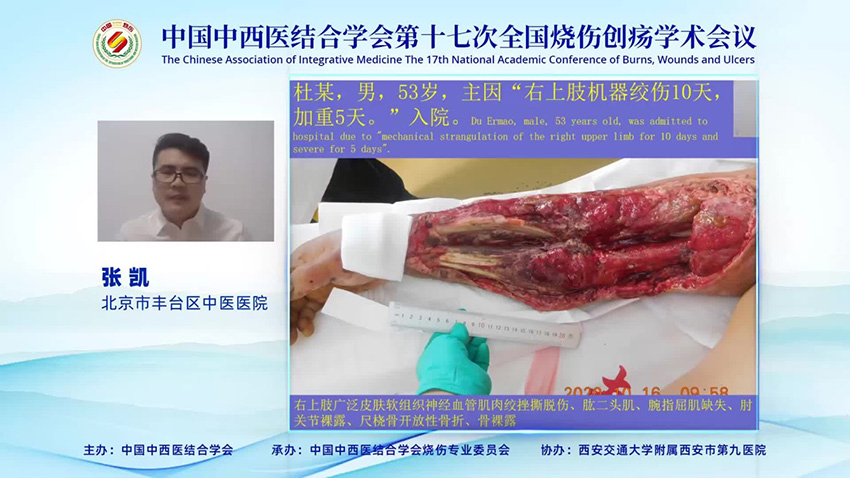 mg冰球突破豪华版(试玩)官方网站