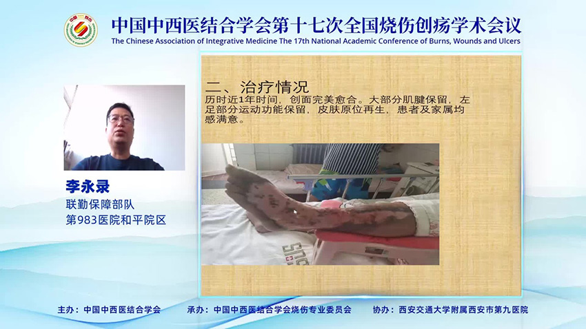 mg冰球突破豪华版(试玩)官方网站