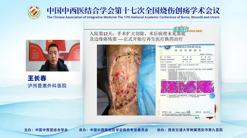 mg冰球突破豪华版(试玩)官方网站