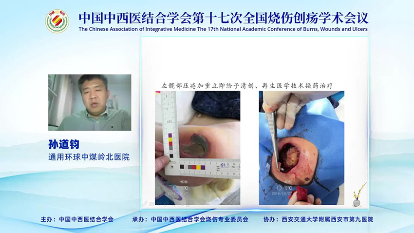 mg冰球突破豪华版(试玩)官方网站