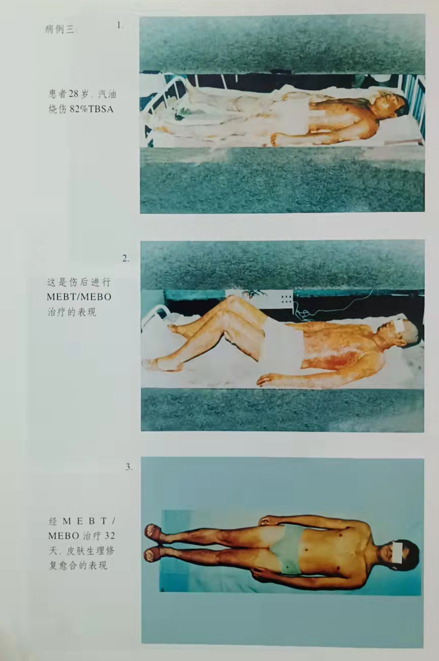 mg冰球突破豪华版(试玩)官方网站