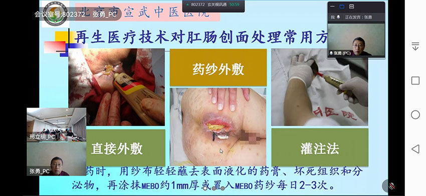 mg冰球突破豪华版(试玩)官方网站