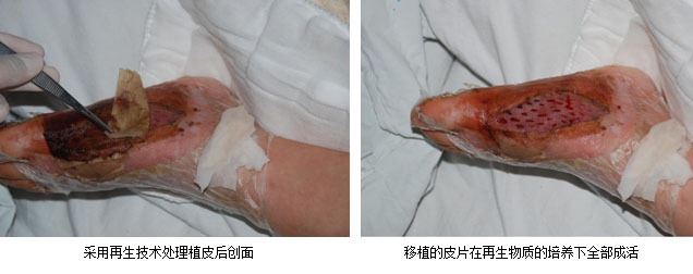 mg冰球突破豪华版(试玩)官方网站