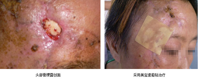 mg冰球突破豪华版(试玩)官方网站