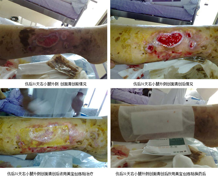 mg冰球突破豪华版(试玩)官方网站