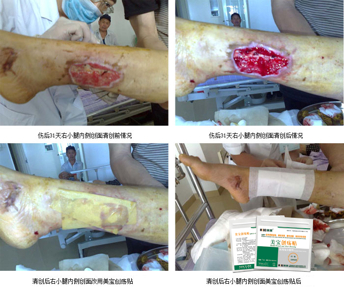 mg冰球突破豪华版(试玩)官方网站