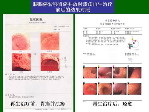 mg冰球突破豪华版(试玩)官方网站