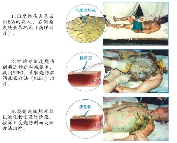 mg冰球突破豪华版(试玩)官方网站