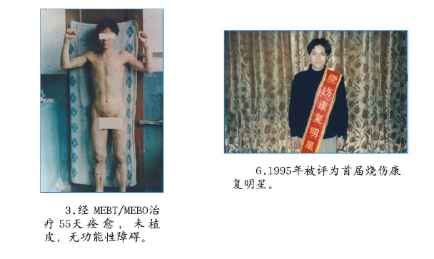 mg冰球突破豪华版(试玩)官方网站