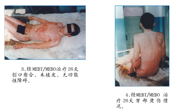mg冰球突破豪华版(试玩)官方网站