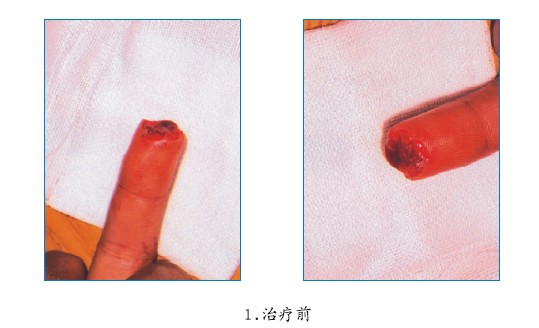 mg冰球突破豪华版(试玩)官方网站