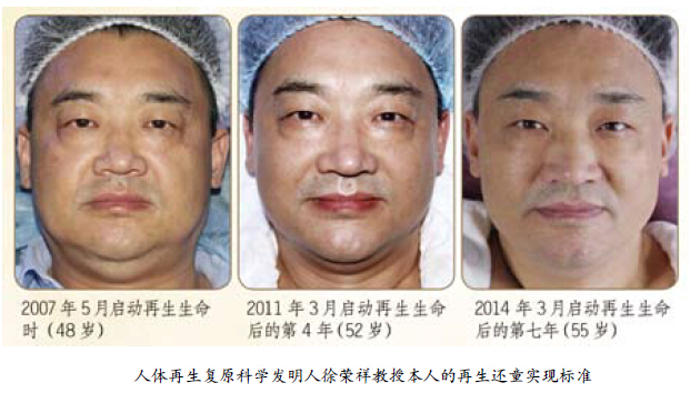 mg冰球突破豪华版(试玩)官方网站