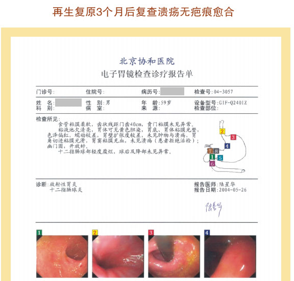 201122014364535